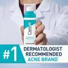 imageCeraVe Resurfacing Retinol Serum For Post Acne Marks Formulated With Licorice Root Extract ampamp Niacinamide Brightening Serum ampamp Pore Minimizer For Face Post Acne Skin Barrier Repair NonComedogenic1 Fl Oz Pack of 1