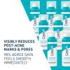 imageCeraVe Resurfacing Retinol Serum For Post Acne Marks Formulated With Licorice Root Extract ampamp Niacinamide Brightening Serum ampamp Pore Minimizer For Face Post Acne Skin Barrier Repair NonComedogenic1 Fl Oz Pack of 1