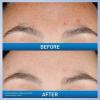 imageCeraVe Resurfacing Retinol Serum For Post Acne Marks Formulated With Licorice Root Extract ampamp Niacinamide Brightening Serum ampamp Pore Minimizer For Face Post Acne Skin Barrier Repair NonComedogenic1 Fl Oz Pack of 1