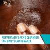 imageCeraVe Acne Control Cleanser 2 Salicylic Acid Treatment Formulated With Niacinamide  Ceramides  Oil Absorbing Clay Gentle Face Wash Helps Clear ampamp Prevent Acne Fragrance Free 16 Ounce16 Fl Oz Pack of 1