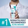 imageCeraVe Acne Foaming Cream Cleanser 4 Benzoyl Peroxide Face Wash With Hyaluronic Acid Niacinamide ampamp Ceramides Gentle Daily Acne Treatment For Face
