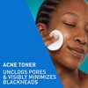 image:imageCeraVe BHA Exfoliating Facial Toner for Pore Minimizing amp Smoother Skin with Ceramides 2 Salicylic Acid amp Niacinamide Oil Control AntiAcne FragranceFree Safe for Sensitive Skin 8oz