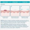 image:imageCeraVe Hydrocolloid Blemish Patches Oil Absorbing Spot Control with Ceramides and Niacinamide AllergyTested amp Suitable For Sensitive Skin UltraThin amp Blends Into All Skin Tones 44ct22 Count Pack of 1